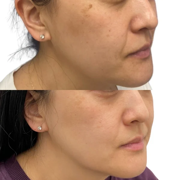 Medical Aesthetic Services in Fountain Valley, CA | LadyBelle Med Spa