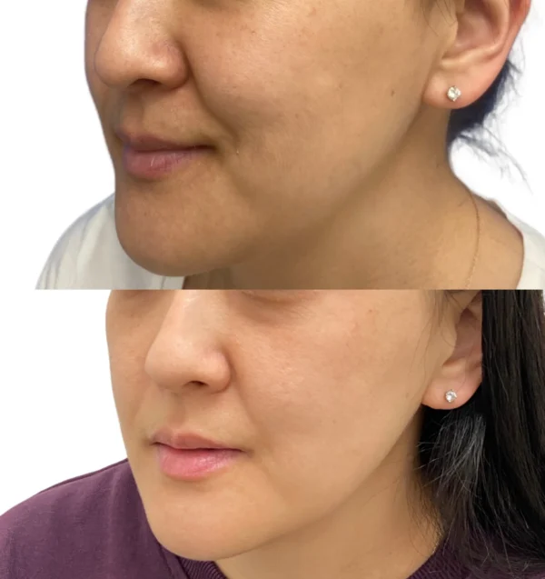 Medical Aesthetic Services in Fountain Valley, CA | LadyBelle Med Spa