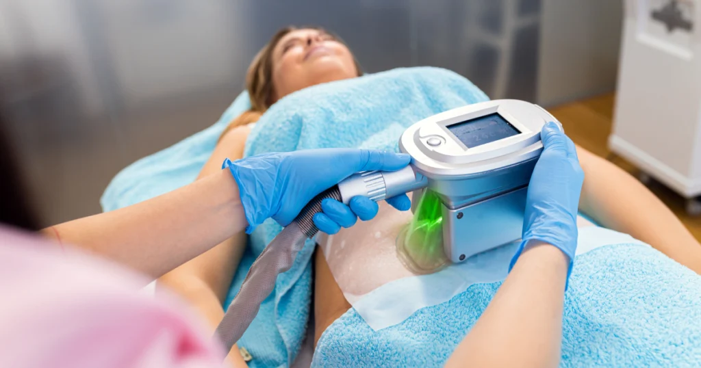 Woman receiving Coolsculpting treatment on abdomen in Fountain Valley, CA spa