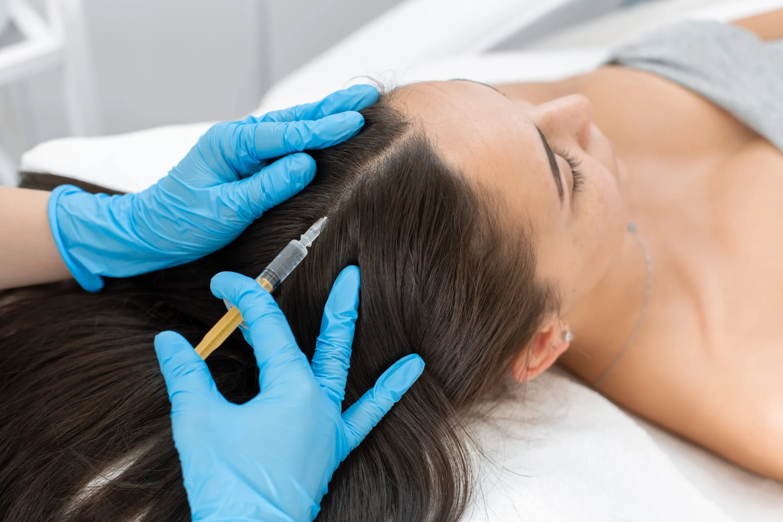 Client Receiving PRP Hair Restoration Treatment in Fountain Valley, CA at LadyBelle Med Spa