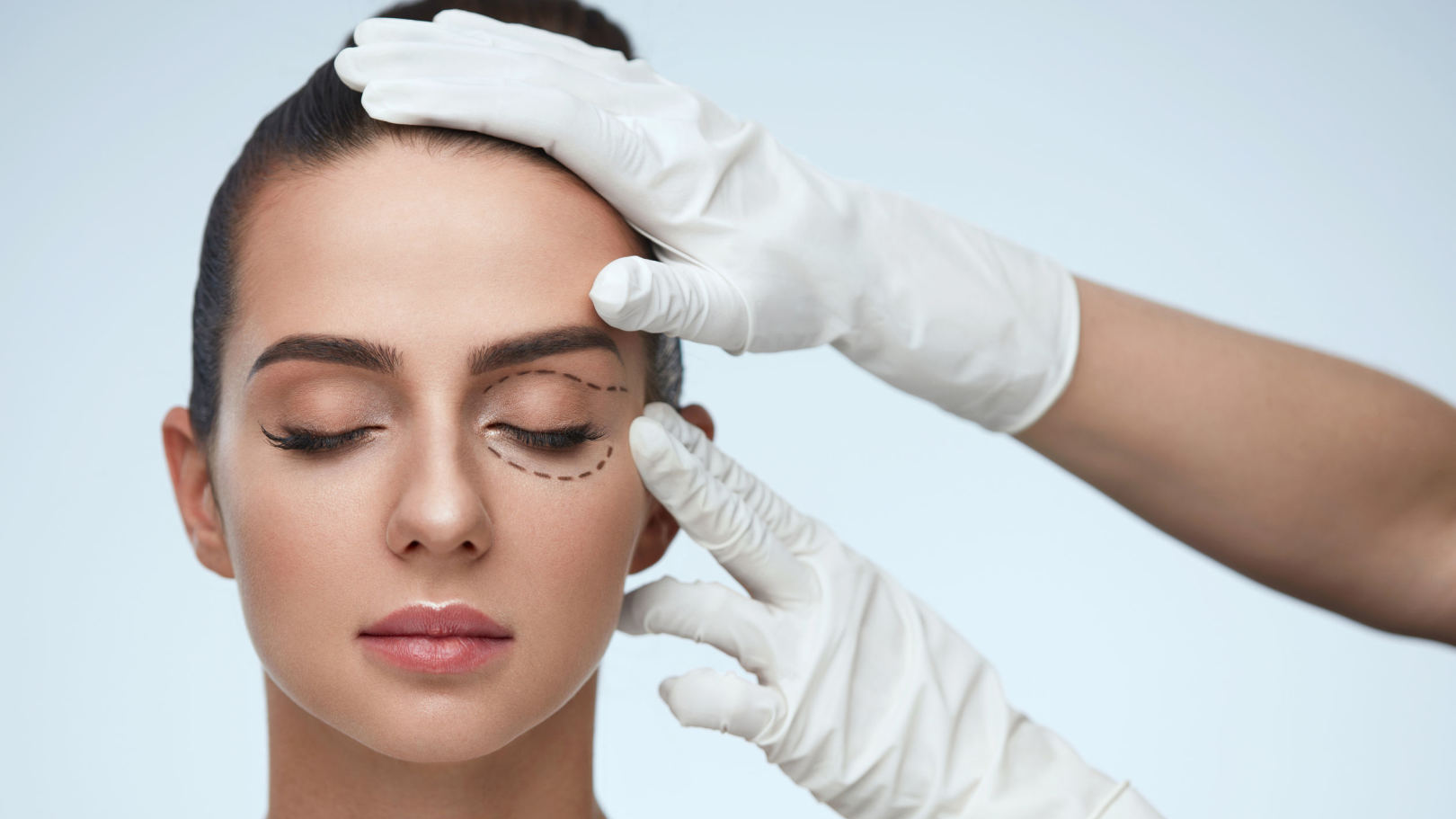 Eyelid Surgery Fountain Valley